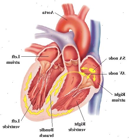 Εμπρόσθια όψη της καρδιάς δείχνει κόλποι στην κορυφή και στο κάτω κοιλίες. Αορτή είναι μεγάλη αρτηρία που εξέρχεται από την καρδιά στην κορυφή. SA κόμβο και κόμβο AV είναι δεξιό κόλπο. Bundle νεύρα υποκατάστημα είναι σε τοίχο μεταξύ των κοιλίες και η καμπύλη εντός της κοιλίας τοίχους. Σήματα από AV κόμβο ταξίδια στο AV κόμβο και σε δέσμη κλάδους.