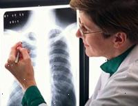 Εικόνα ενός θηλυκού ακτινολόγο που θα διαβάζει ένα x-ray