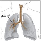 Δύο τρόποι άσθμα περιορίζει την αναπνοή