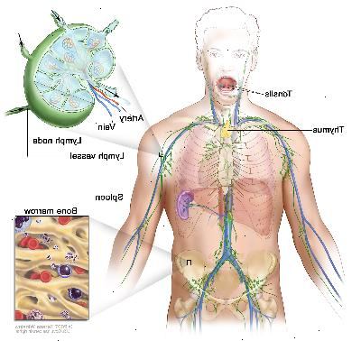 Λεμφικό σύστημα? Σχήμα δείχνει τα λεμφαγγεία και λεμφαδένες όργανα συμπεριλαμβανομένων των λεμφαδένων, αμυγδαλές, θύμος αδένας, σπλήνα, και τον μυελό των οστών. Ένα ένθετο δείχνει το εσωτερικό δομή ενός λεμφαδένα και τα συνημμένα λεμφαγγείων με βέλη που δείχνουν το πώς η λέμφος (διαυγές υγρό) κινείται μέσα και έξω από λεμφαδένα. Ένα άλλο ένθετο δείχνει μια στενή επάνω του μυελού των οστών με κύτταρα του αίματος.