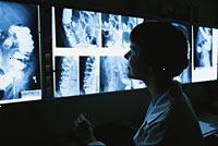 Εικόνα ενός ιατρού που βλέπουν βαρίου υποκλυσμό φιλμ ακτίνων Χ