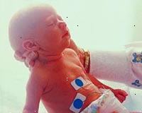 Εικόνα ενός νεογέννητου στη μονάδα εντατικής θεραπείας νεογνών