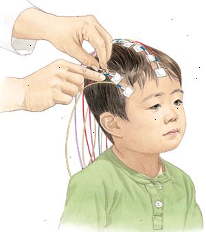 Κατά τη διάρκεια ενός EEG, τα ηλεκτρόδια τοποθετούνται στο τριχωτό της κεφαλής του παιδιού σας έτσι ώστε η ηλεκτρική δραστηριότητα του εγκεφάλου μπορεί να καταγραφεί.