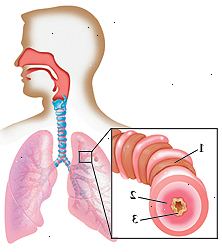 Περίγραμμα ανθρώπινο κεφάλι και το στήθος με το κεφάλι γυρισμένο στο πλάι δείχνει στο εσωτερικό της μύτης, του λάρυγγα και την τραχεία που οδηγούν στους πνεύμονες στο στήθος. Κοντινό πλάνο του δείχνει αεραγωγών σφιγμένα μυς, πρησμένο επένδυση, και την αύξηση της βλέννας.